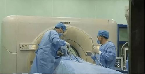 康博刀,最具性價(jià)比的治療選擇